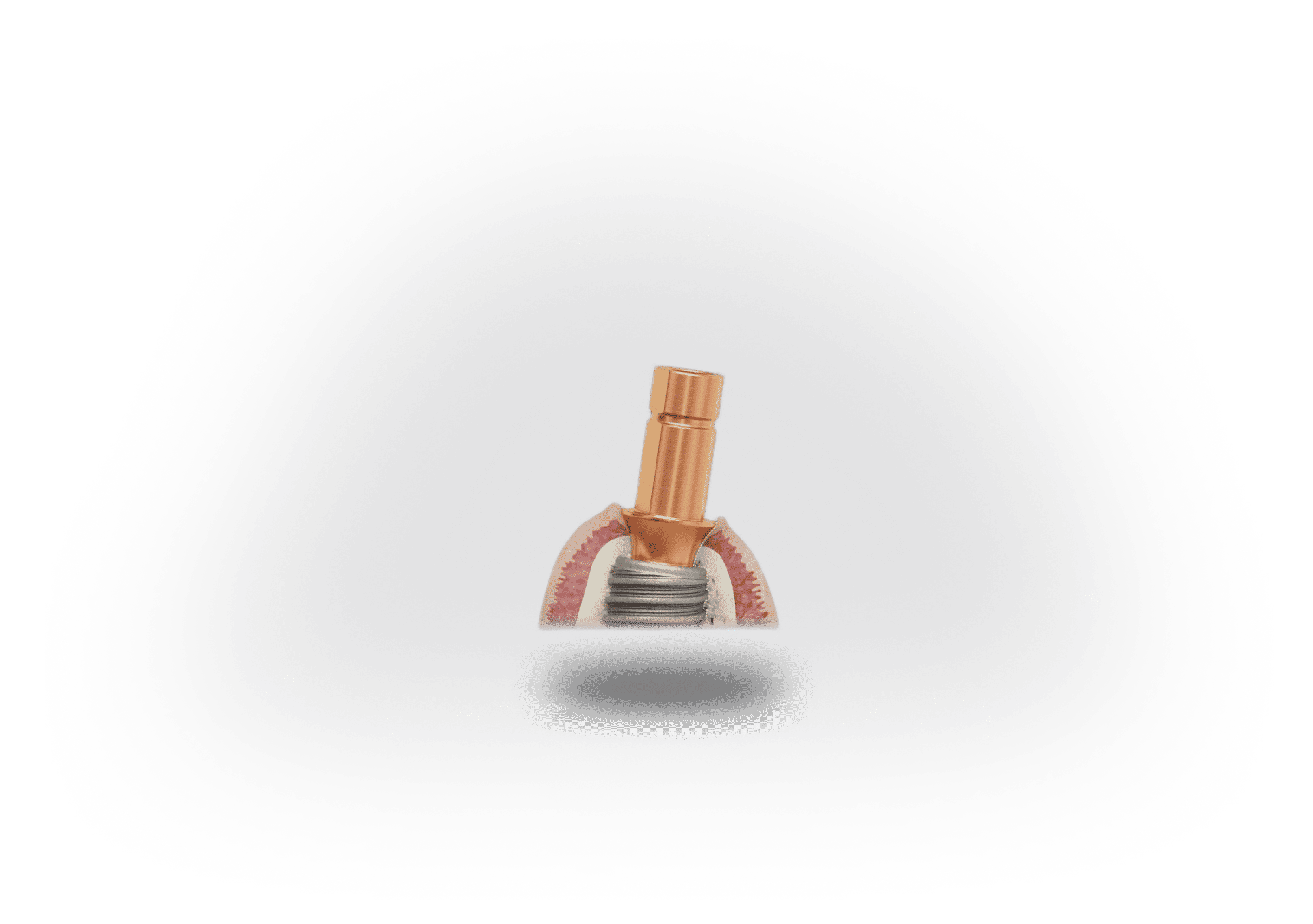 roott-r-1